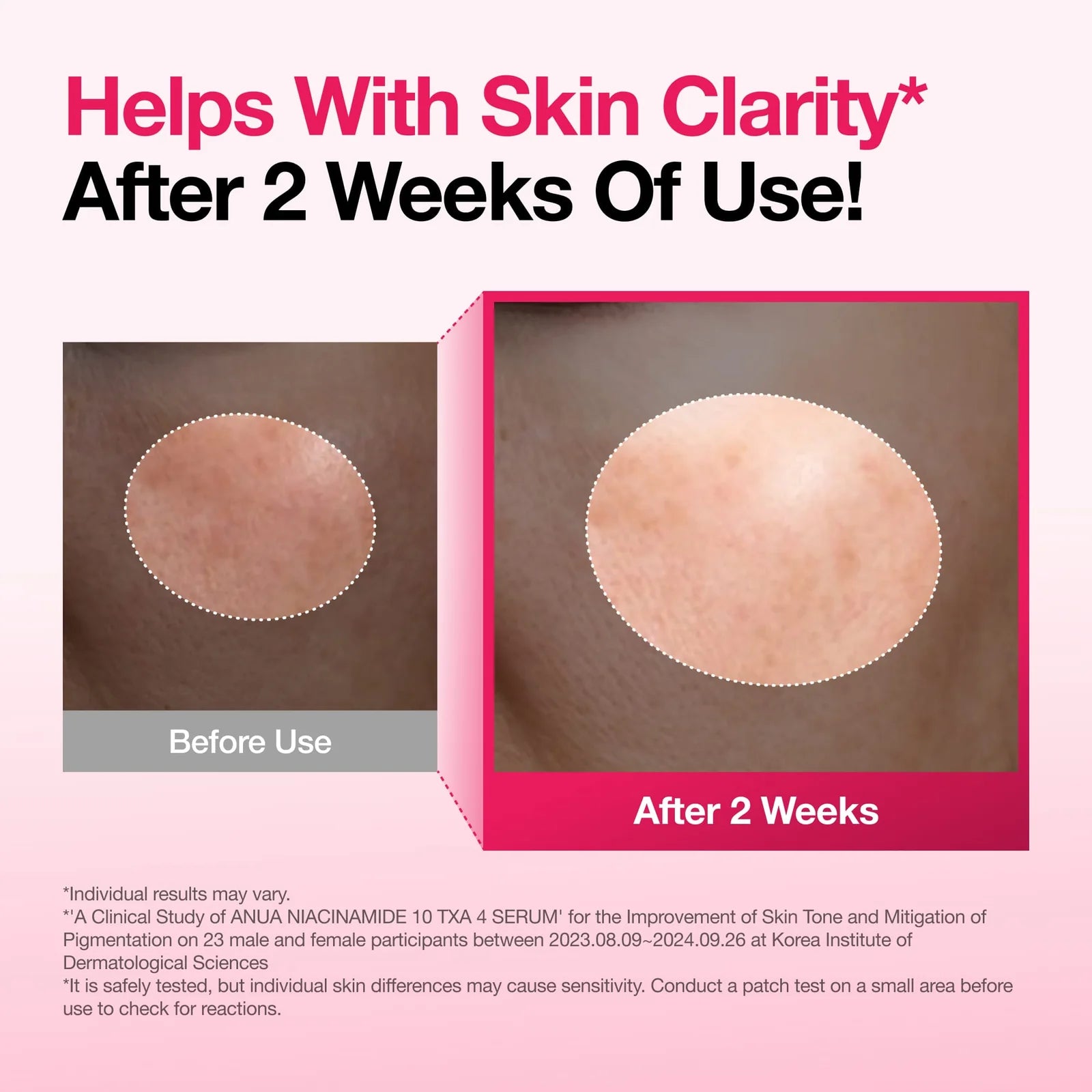 Spotless Skin Duo