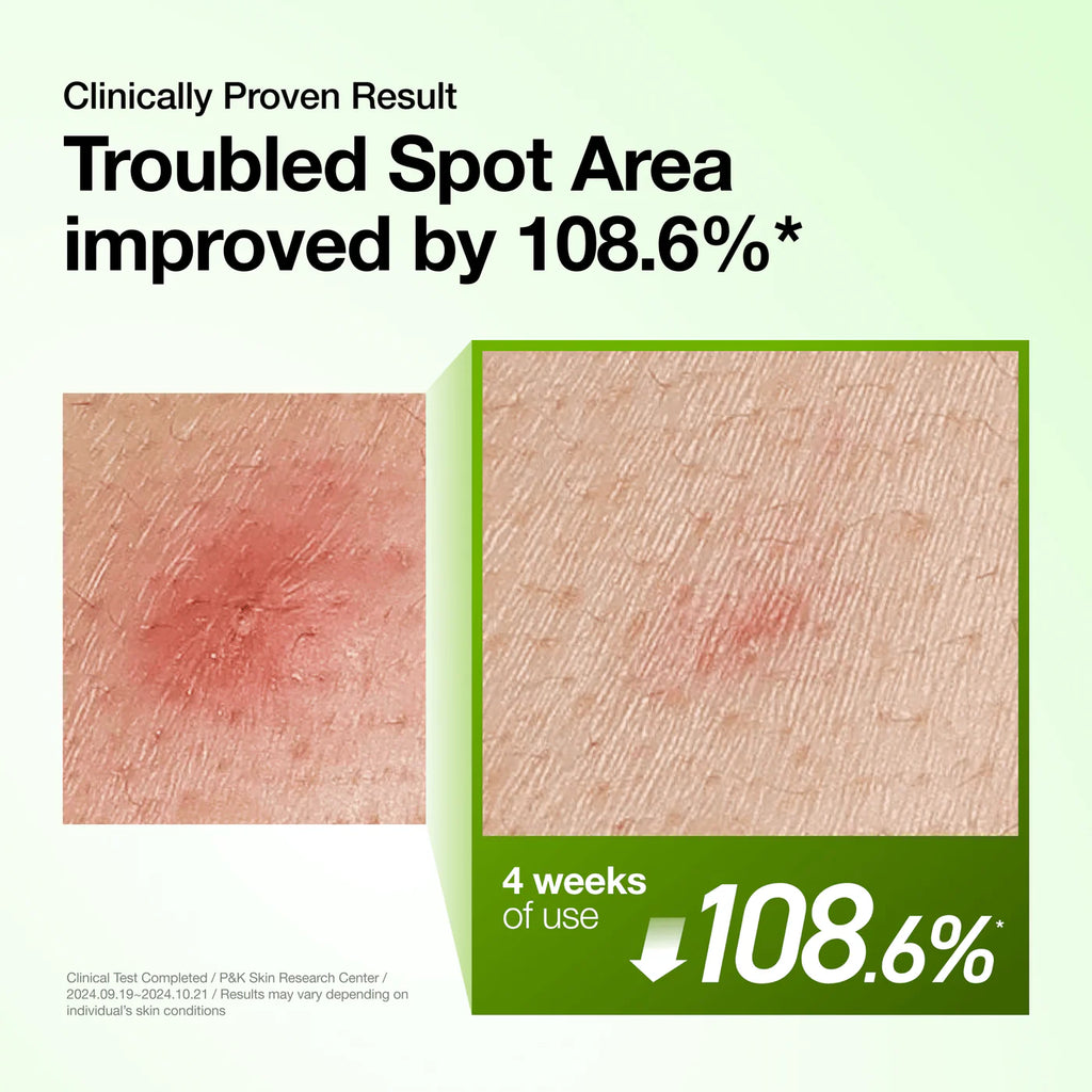 Azelaic Acid 10 Hyaluron Redness Soothing Serum
