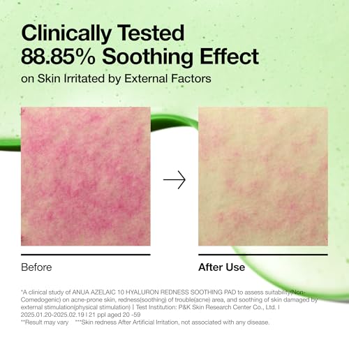 Anua Azelaic Acid Redness Soothing Prep & Boost Duo