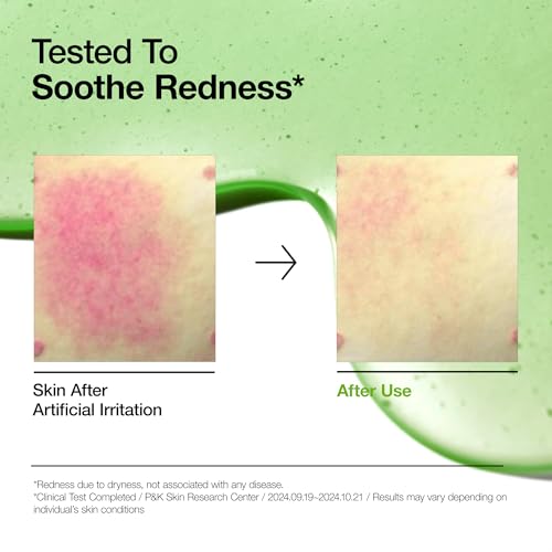 ANUA Azelaic Acid Total Soothing Trio | Azelaic Acid & CICA Skincare Set | Lightweight Hydration & Skin Barrier Care | Korean Skincare